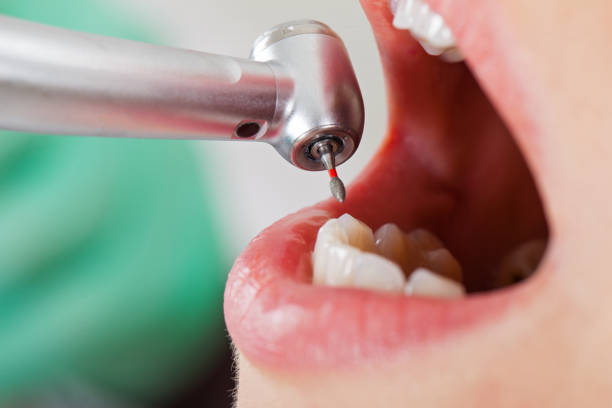 Emergency Dentist Open Today in NE